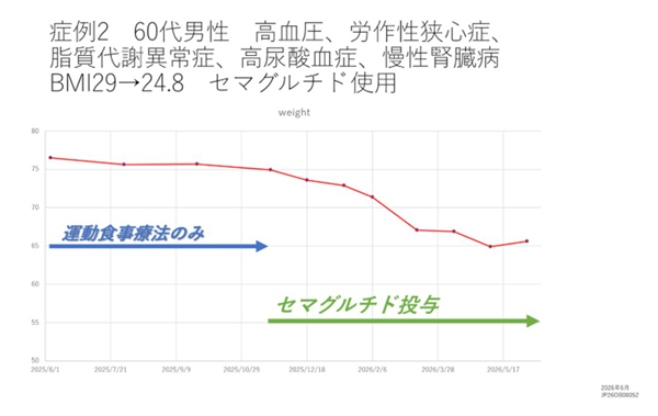 症例2